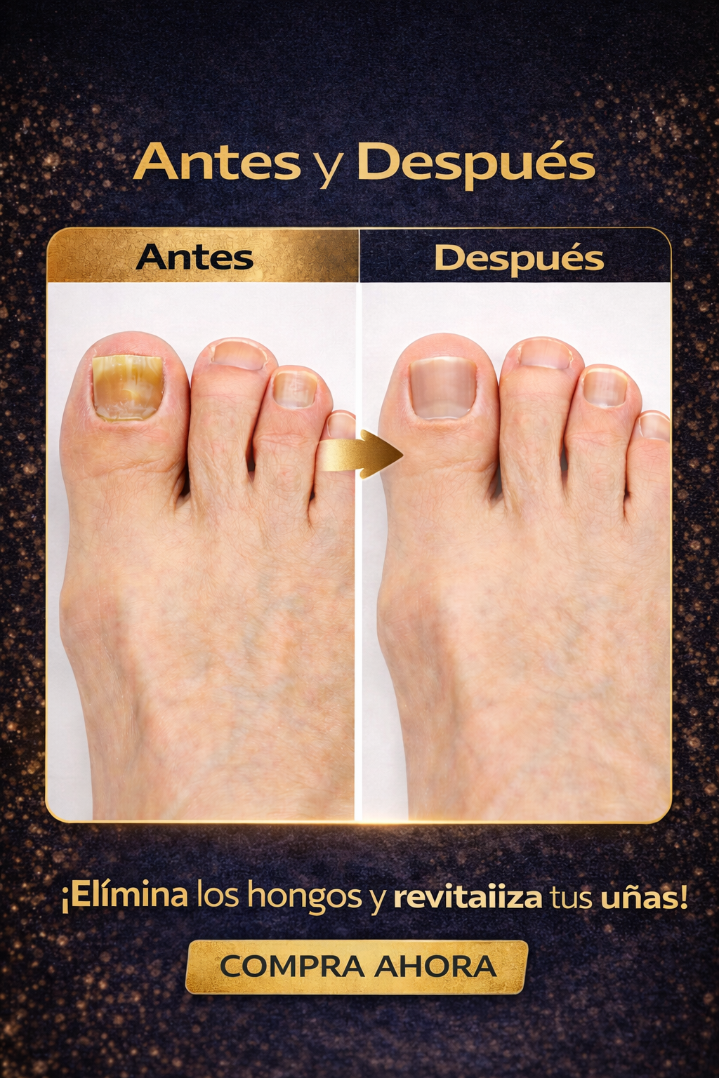 💪🔍ANTIHONGOS UÑAS 2x1💅💅